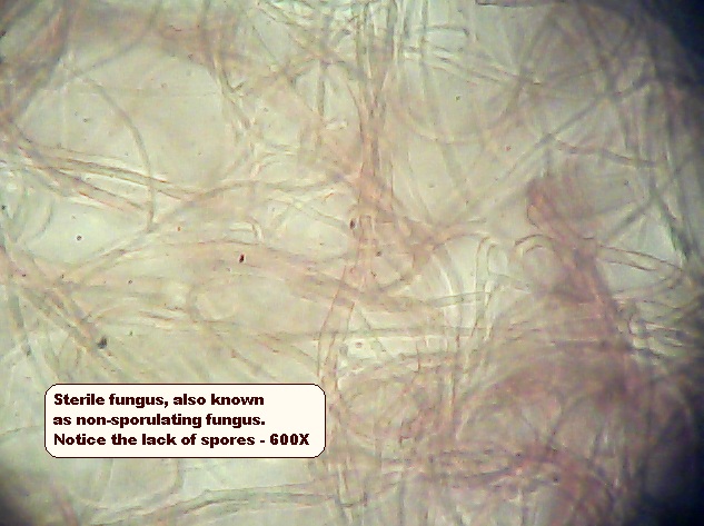 Sterile Fungus